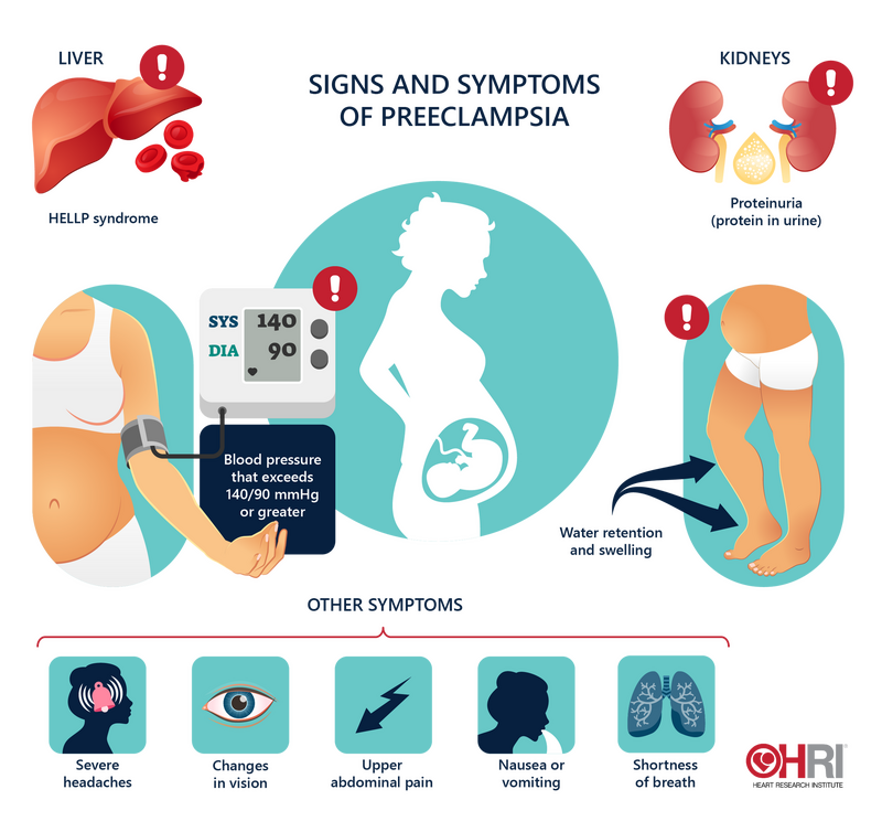 Preeclampsia symptoms HRI 01 01